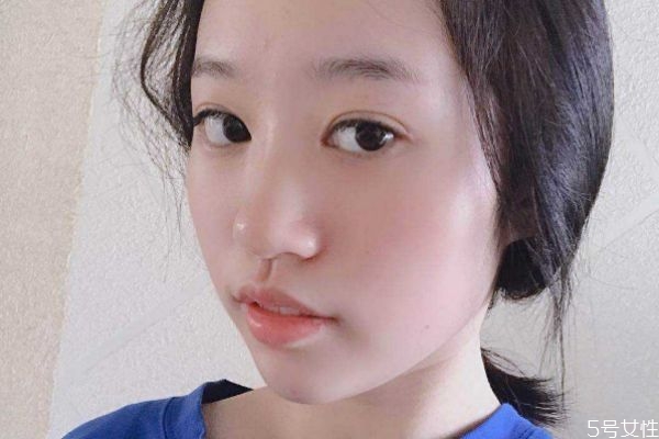 玻尿酸填充鼻子后注意事项,玻尿酸隆鼻后的注意事项有哪些