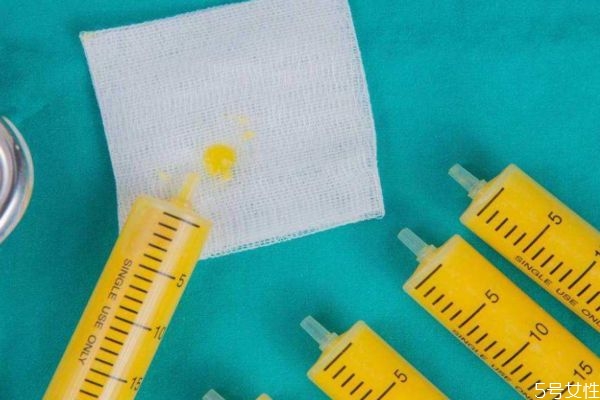 小腿抽脂会不会反弹,小腿吸脂会反弹吗