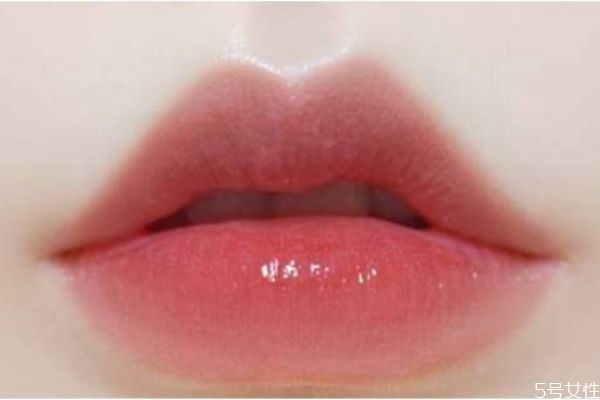 打嘟嘟唇多久恢复自然,打完嘟嘟唇多久能自然 打嘟嘟唇多久恢复自然,打完嘟嘟唇多久能自然