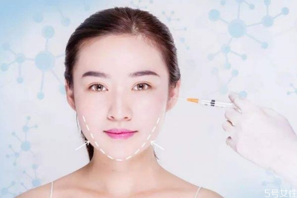 双下巴打瘦脸针有用吗?,双下巴可以打瘦脸针去除吗