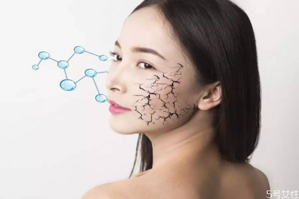 热玛吉是什么原理,玛热吉的原理