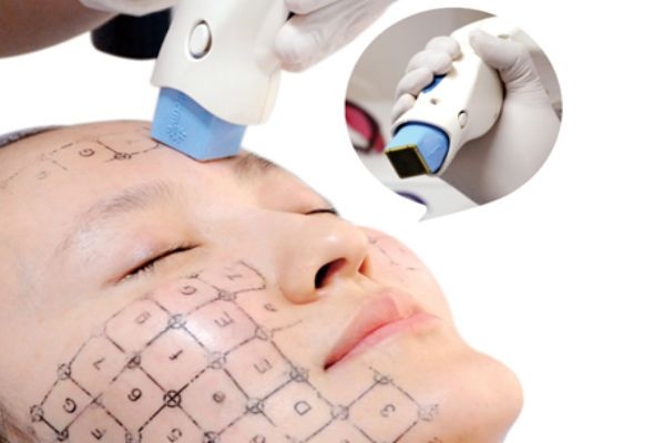 热玛吉适合人群,什么人适合做热玛吉 热玛吉适合人群,什么人适合做热玛吉