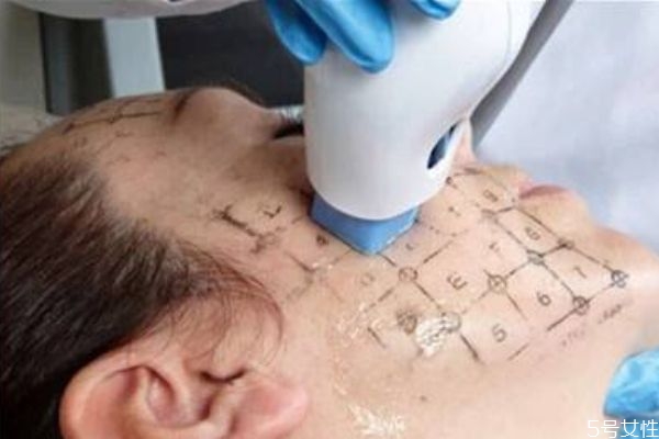 做热玛吉多少钱一次,热玛吉多久做一次合适