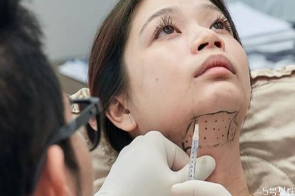 溶脂针瘦双下巴多久能见效,双下巴溶脂针多久见效果