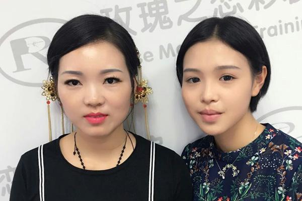 我做了上睑松弛整形术,上睑皮肤松弛矫正手术