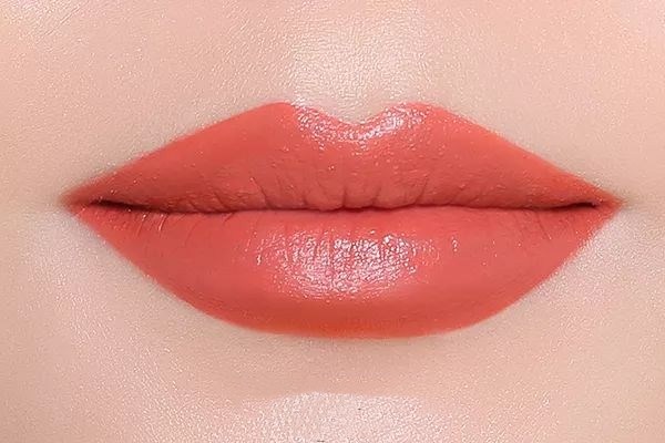 厚唇变薄术,厚唇修薄手术