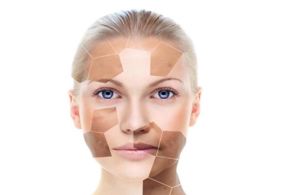 垫鼻子的危害,垫鼻子有什么副作用 垫鼻子的危害,垫鼻子有什么副作用