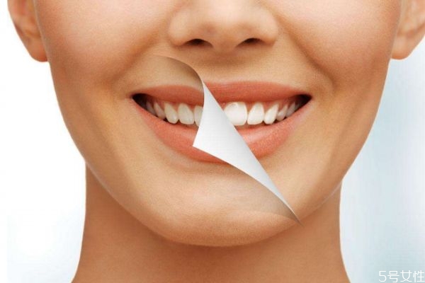 冷光美白牙齿可以维持多久,冷光美白牙齿有效果吗