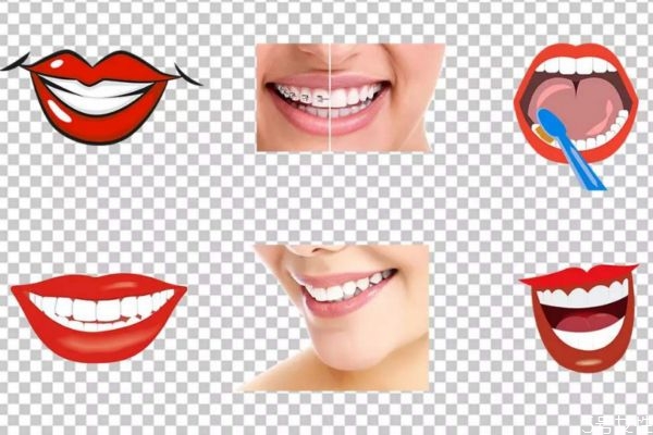 冷光美白牙齿疼吗?,做了冷光美白牙疼死了