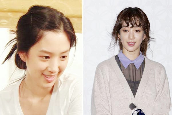 做拉皮手术多长时间能完全恢复,脸上拉皮手术多久能恢复