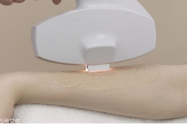 冰点脱毛是啥,冰点脱毛是什么样的