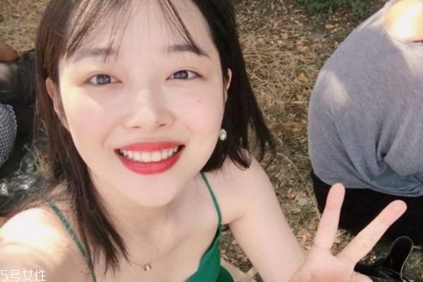 有必要做激光去痘印吗,激光祛痘印好不好