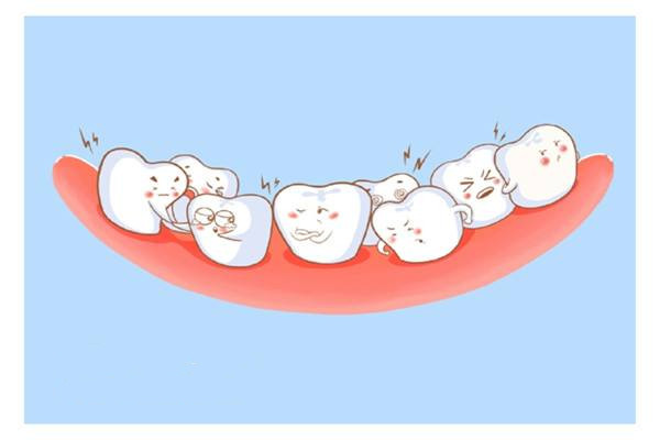 什么是错颌畸形,什么是反颌