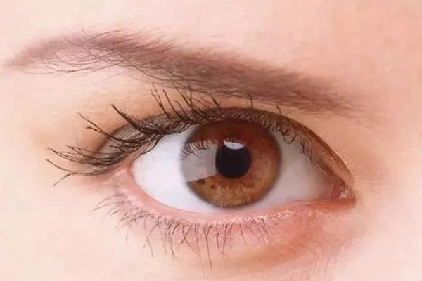 怎么分辨眼袋和卧蚕,眼袋和卧蚕有什么区别