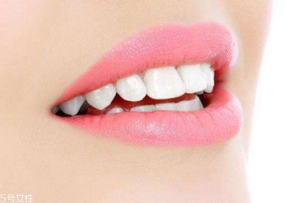 烤瓷牙要怎么保养,烤瓷牙怎样保养注意事项