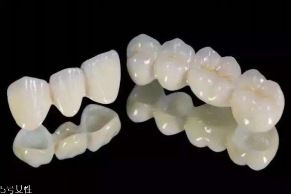 烤瓷牙对身体有害吗,什么叫烤瓷牙?有什么优缺点? 烤瓷牙对身体有害吗,什么叫烤瓷牙?有什么优缺点?