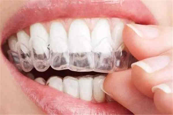 牙齿矫正有年龄要求吗,做牙齿矫正的年龄限制