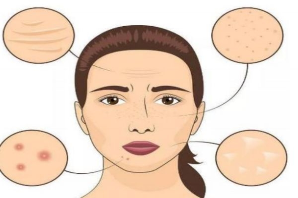 什么是热玛吉呢?,啥是热玛吉