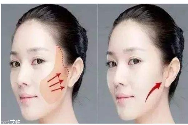 做一次超声刀可以维持多久,超声刀可以保持多久 做一次超声刀可以维持多久,超声刀可以保持多久