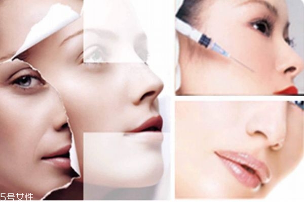 爱贝芙一针一般多少钱,爱贝芙注射多少钱一只