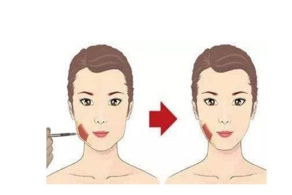 什么叫咬肌,咬肌是什么样的