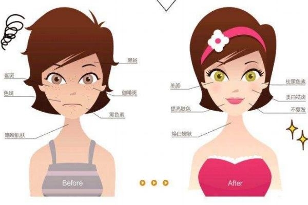 点阵激光有啥用,点阵激光干嘛用的