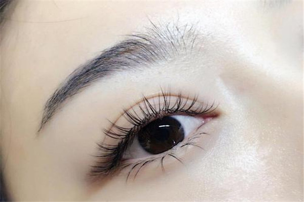 开眼角后怎么防止增生,开眼角增生了怎么办可以修复吗