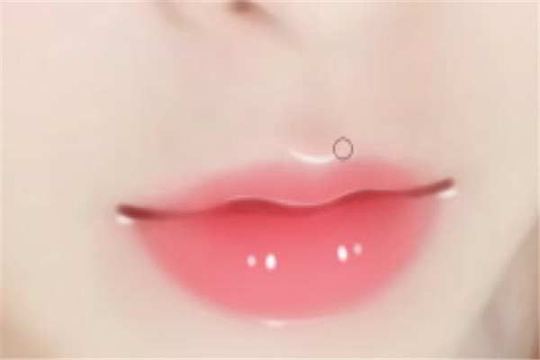 嘴角上扬手术后悔死了,做嘴角上扬手术好不好