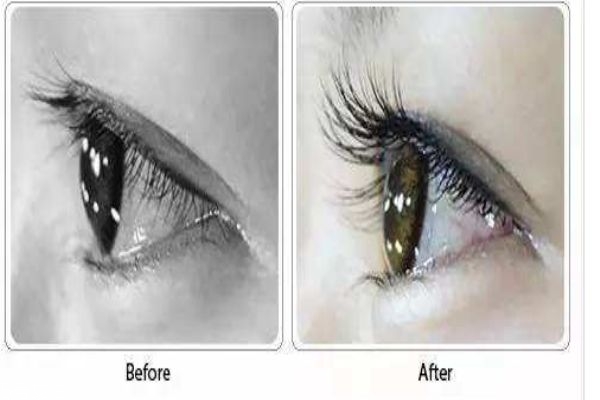 什么是种睫毛,种睫毛的睫毛是什么毛