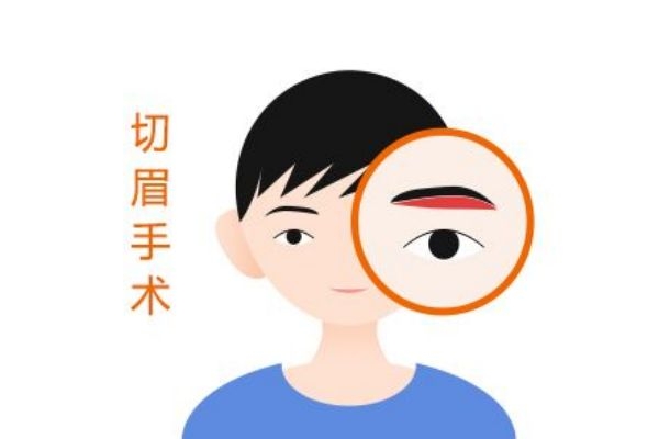 切眉的效果,切眉有什么作用