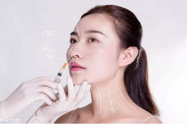 割双眼皮需要多久才能出去见人,手术完成后多久人能出来