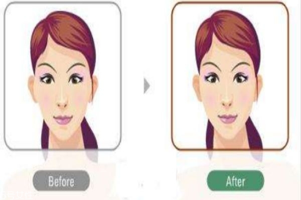 削骨有什么危害,削骨哪个效果好