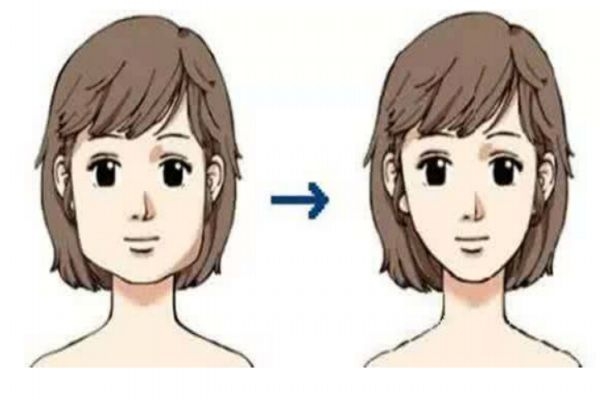 瘦脸针有副作用吗可以保持多久,打瘦脸针有副作用吗? 瘦脸针有副作用吗可以保持多久,打瘦脸针有副作用吗?