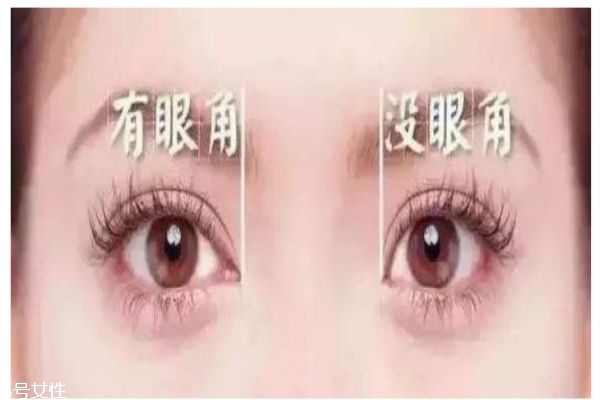 开眼角有什么好处,开眼角的坏处