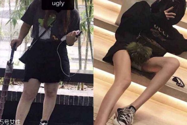 瘦腿针可以反复打吗,瘦腿针要一直打吗