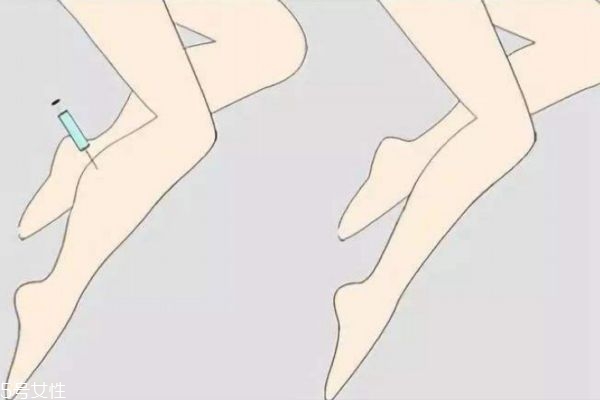 打完瘦腿针腿反而粗了,打了瘦腿针20天反而更粗了 打完瘦腿针腿反而粗了,打了瘦腿针20天反而更粗了