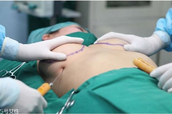 假体隆胸后多久可以趴着睡,假体隆胸后趴着睡就可以不按摩了吗