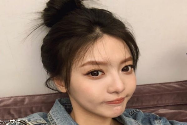 自体脂肪填充脸部可以维持多久?,自体脂肪填充面部多久可以上班