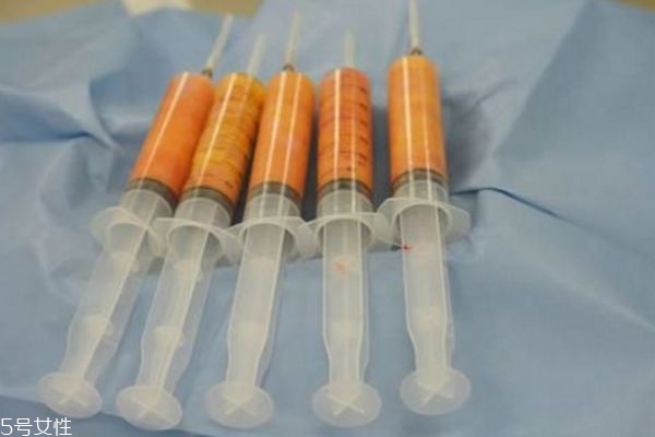 脂肪填充后多久可以用护肤品,面部脂肪填充多久可以用护肤品