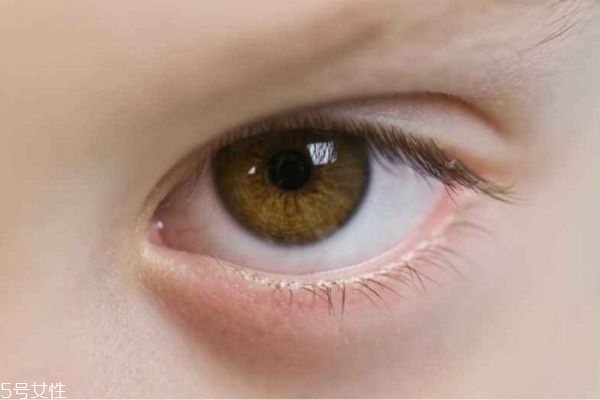 肿眼泡可以消除吗,怎么可以消除肿眼泡