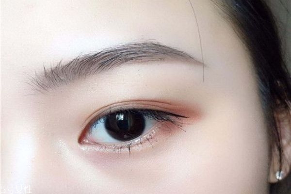 双眼皮回缩是怎么回事,双眼皮恢复好会回缩多少