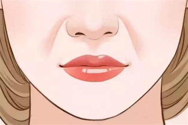 自体脂肪填充鼻唇沟多少钱,自体脂肪填充鼻唇沟的效果