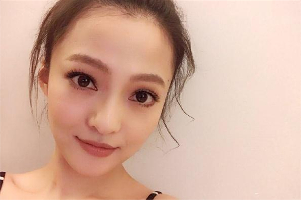 激光祛红血丝几天能好,激光祛红血丝后多久可以完全恢复 激光祛红血丝几天能好,激光祛红血丝后多久可以完全恢复