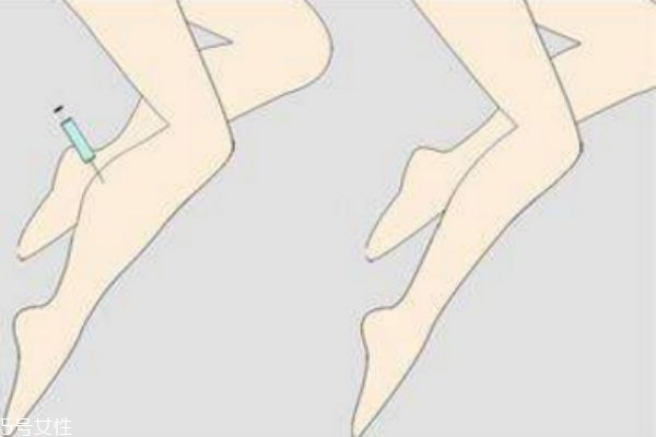 打瘦腿针可以保持多久,瘦腿针多久有效果