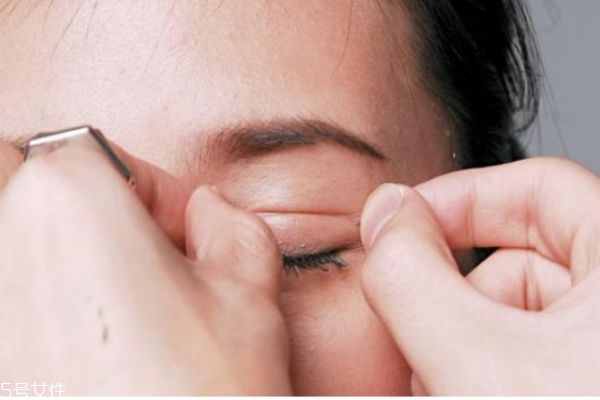 怎么判断是不是眼睑下垂,上眼睑下垂怎么治疗