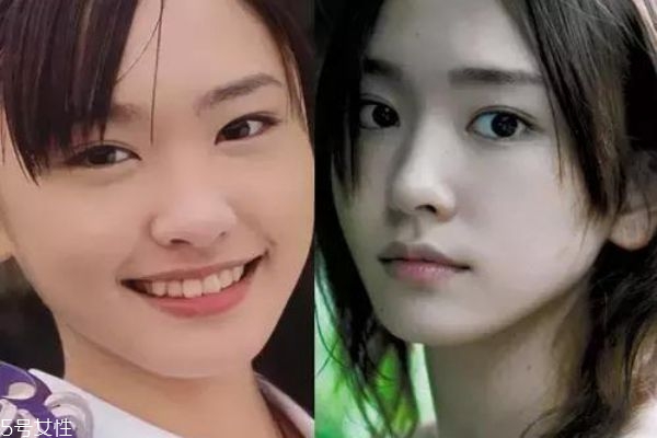 眼睑下至手术是什么,双眼皮下至是什么 眼睑下至手术是什么,双眼皮下至是什么