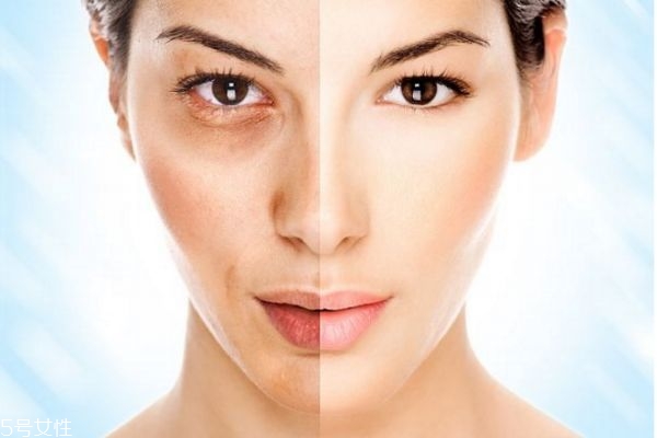 美白针可以自己打吗,美白针能不能打