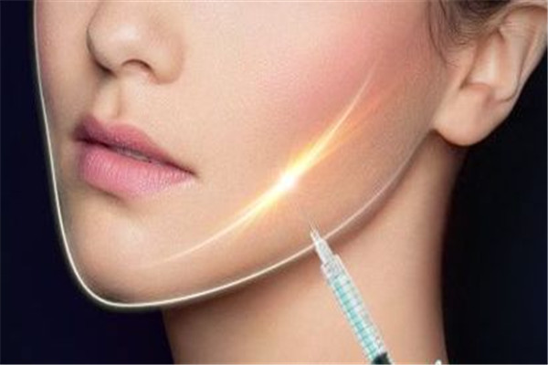 自体脂肪能填充下巴吗,自体脂肪丰下巴维持多久