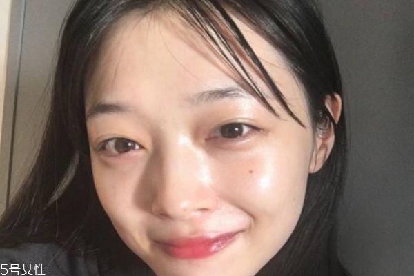 什么是王者风范,王者风范嫩肤后遗症