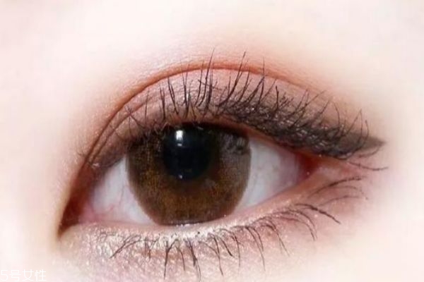 肿眼泡适合做什么类型的双眼皮,肿眼泡适合做什么样的双眼皮